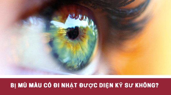 Bị mù màu có đi Nhật được diện kỹ sư không?
